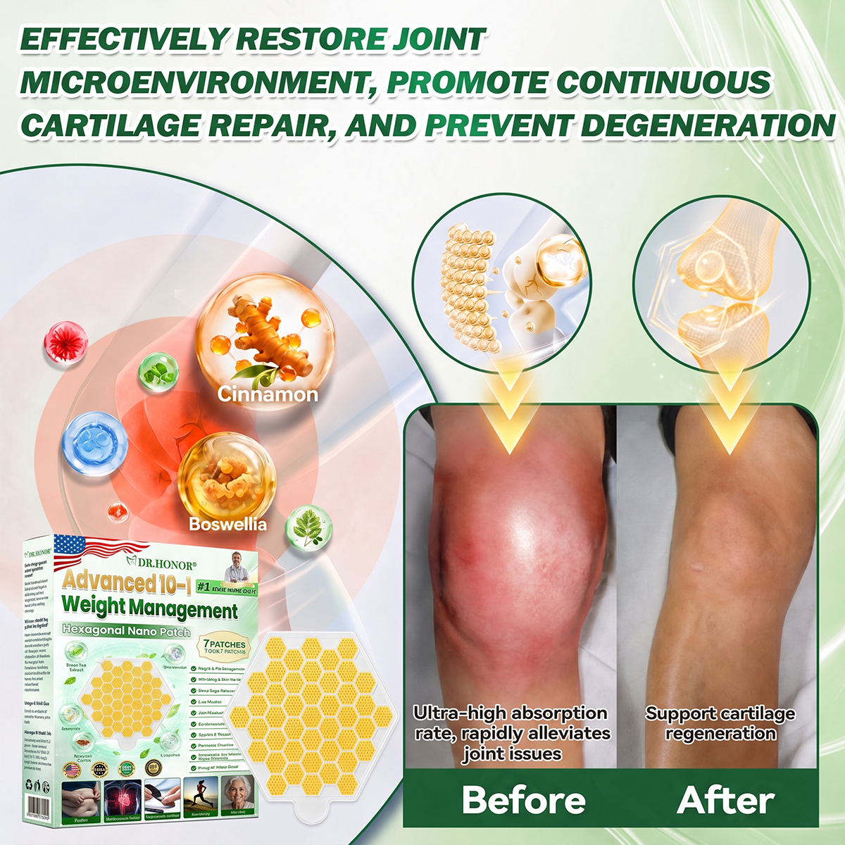 💤💤💤𝑶𝒇𝒇𝒊𝒄𝒊𝒂𝒍 𝑺𝒕𝒐𝒓𝒆  | 1️⃣DR.HONOR® 𝐴𝑑𝑣𝑎𝑛𝑐𝑒𝑑 𝐻𝑒𝑥𝑎𝑔𝑜𝑛𝑎𝑙 𝑁𝑎𝑛𝑜 𝑊𝑒𝑖𝑔ℎ𝑡 𝑀𝑎𝑛𝑎𝑔𝑒𝑚𝑒𝑛𝑡 𝑃𝑎𝑡𝑐ℎ